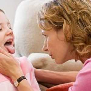Херпес болки во грлото кај децата - Третман