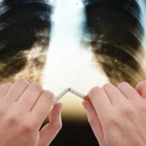 COPD - животен век