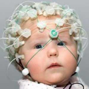 Мозокот ЕЕГ кај деца