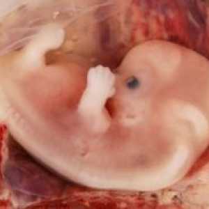 Човечки ембрион