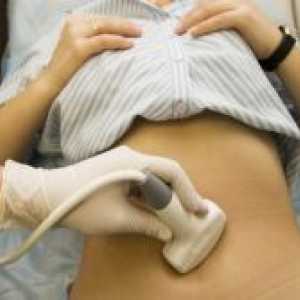 Endometrioid циста на јајниците право