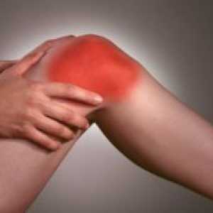 Како да се третираат остеоартритис на коленото?