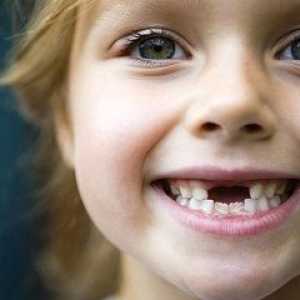 Како да се промени на забите кај децата