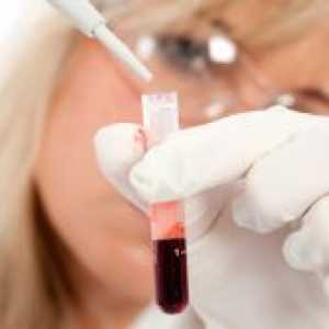 Како да се утврди крвна група?