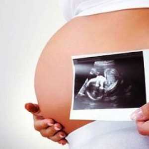 Како да се идентификуваат Даунов синдром во бременоста
