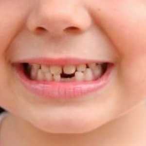 Кои се заби падне кај децата?