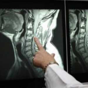 Компјутеризирана томографија на 'рбетот