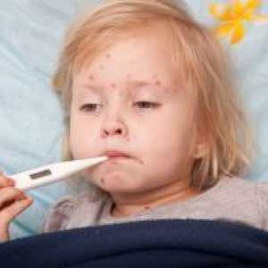 Мали сипаници кај децата