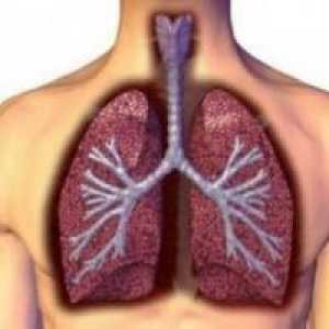 Лобарна пневмонија