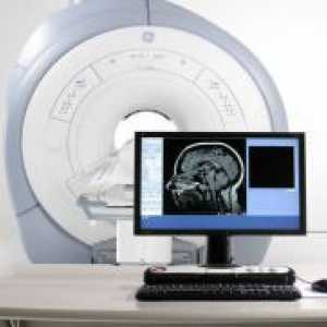 Компјутеризирана томографија на мозокот