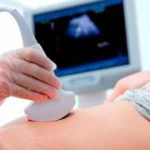 Лапароскопија матката fibroids