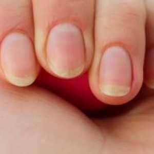 Кршливи нокти - Причини