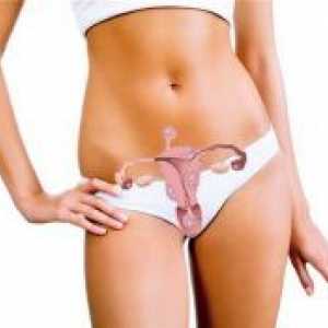 Повеќе fibroids матката