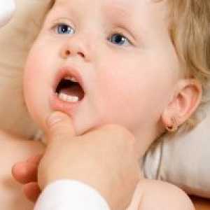 Кандидијаза кај децата - Третман