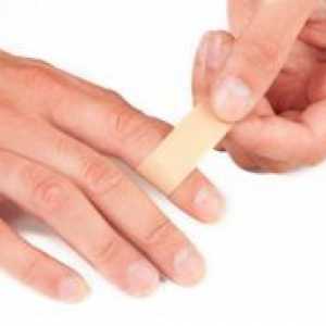 Апсцес на прстот - Третман