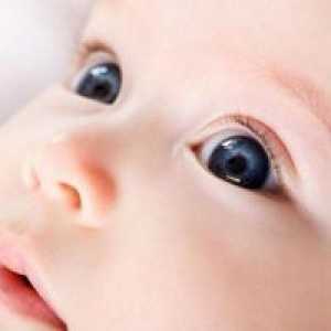 Опструкција на солза канал кај новороденчињата