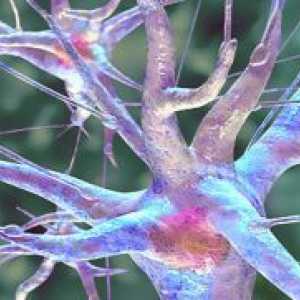 Невритис на sciatic нерв