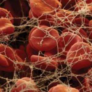 Ниско ниво на тромбоцити во крвта - причина