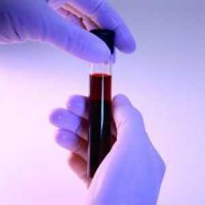 Норма на билирубинот во крвта