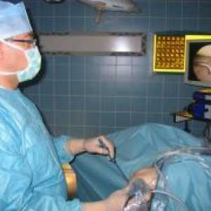 Операција на менискусот на коленото