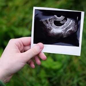 Утврдување на полот на детето на ултразвук