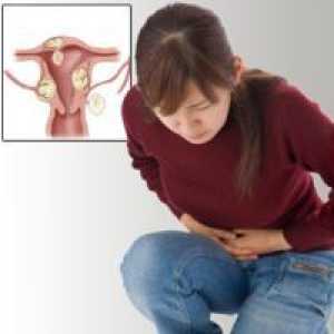 Тумор на јајниците кај жените - Третман