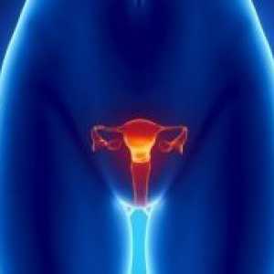 Тумор на матката - симптоми