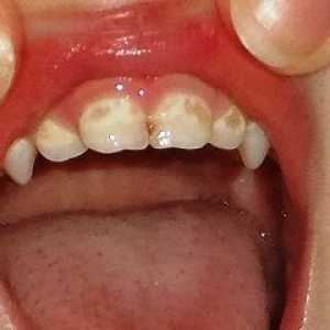 Дамки на забите на детето