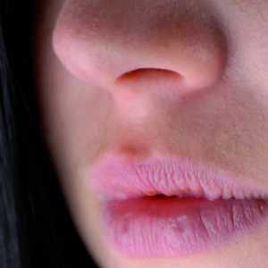 Зошто испукани усни