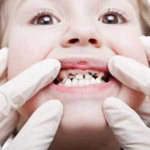 Зошто децата се претвори црно бебе заби?