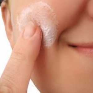 Себороичен дерматитис на лицето - Третман