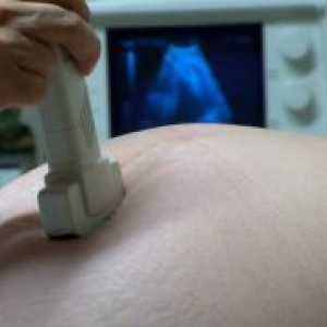 Чукање на срцето на фетусот за време на бременоста