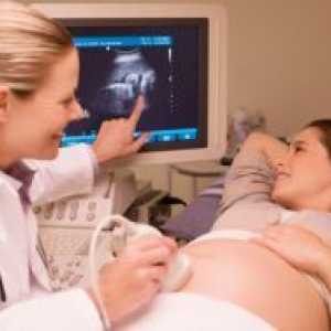 Чукање на срцето на фетусот во 12 недели