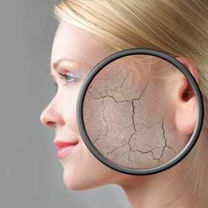 Силно лушпеста кожа на лицето: Причини и третман