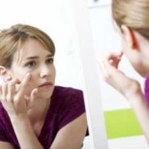 Модринки под очите - причини и третман