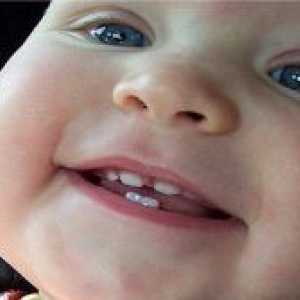 Колку млечните заби кај децата?