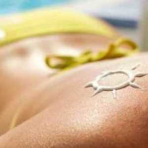 Сончево изгореници на кожата - третман