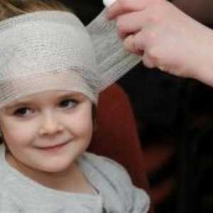 Потрес на мозокот - симптомите кај децата