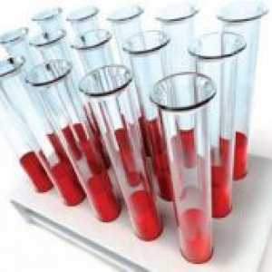 Компатибилноста на крвни групи за зачнување