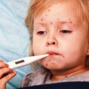 Streptoderma кај децата - третман лекови