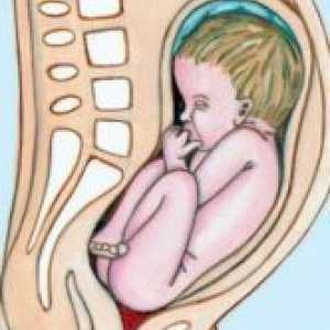 Карлична презентација на фетусот - Причини