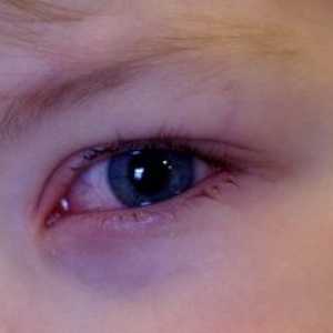 Детето има црвени очи, зошто и што да направам?