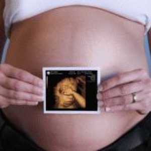 Ултразвук на фетусот 12 недели