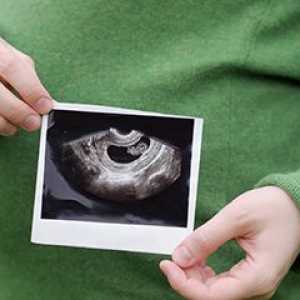 Узи во текот на бременоста: времеплов