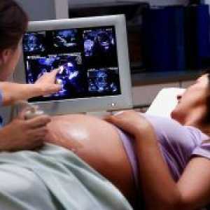 Узи на 33 недели од бременоста - правила