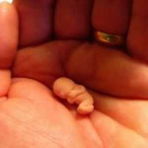 Спонтан абортус во раната бременост