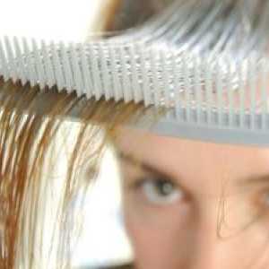 Губење на косата кај жените